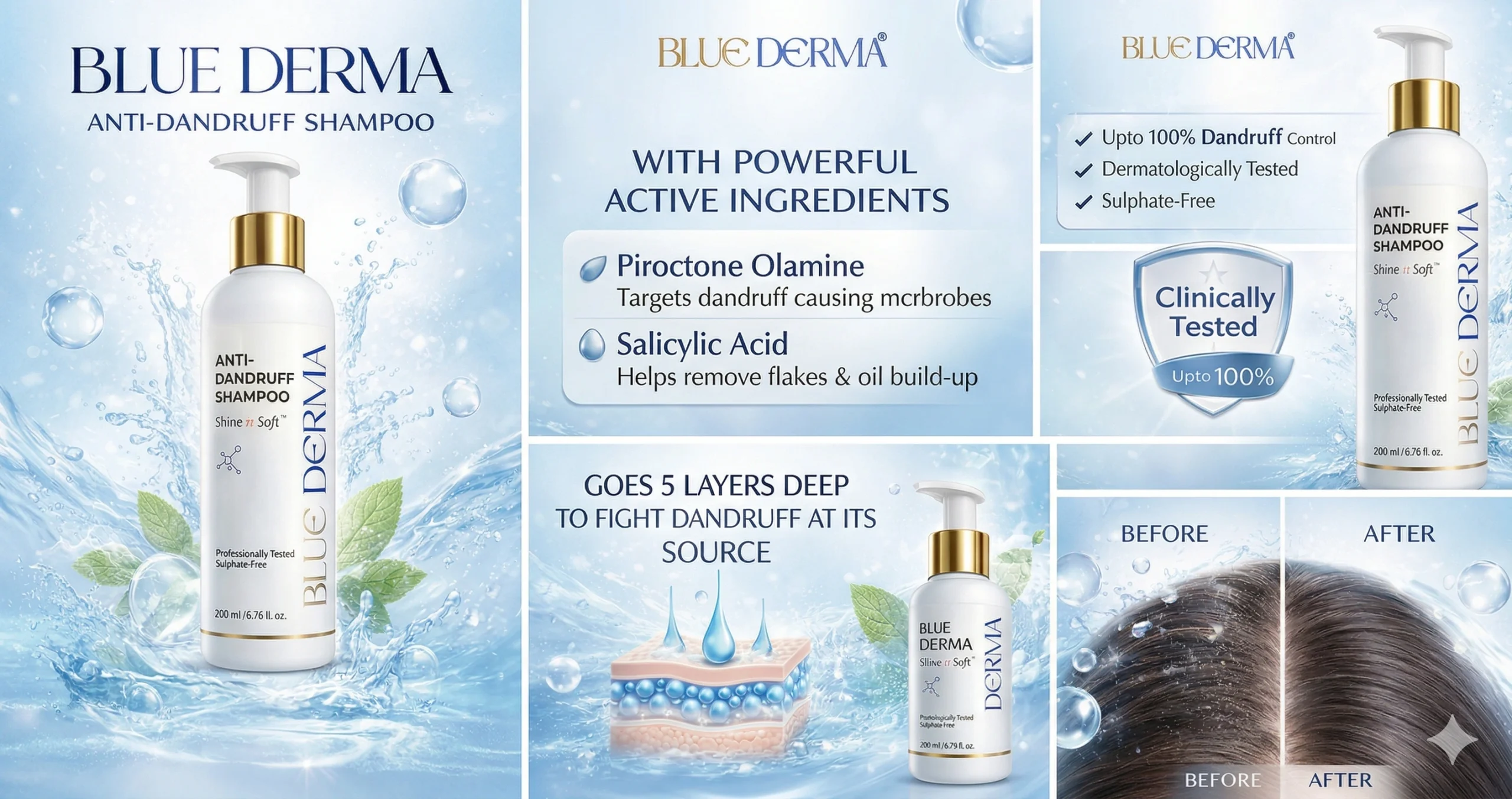 Best Shampoo for Dry Scalp in India Bluederma