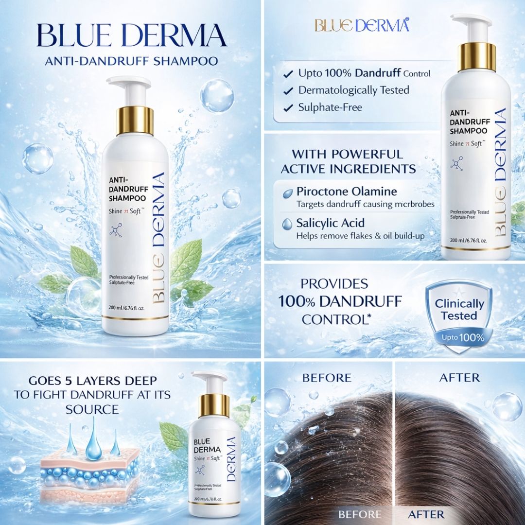 shampoo for dry scalp